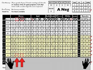 Video - Antibody Identification 2; Basic Cases - Blood Bank Guy