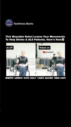 A Wearable Robot That Learns to Assist Stroke & ALS Patients#engineering#robotics