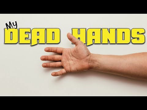 MS Symptoms Hands