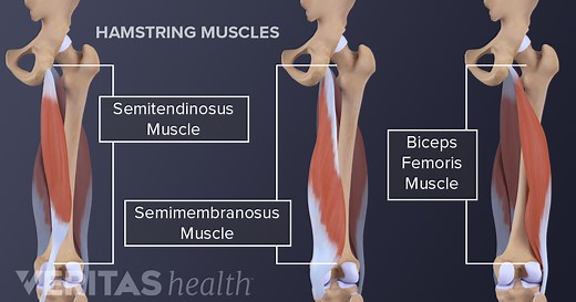 Hamstring Stretching Exercises for Sciatica Pain Relief