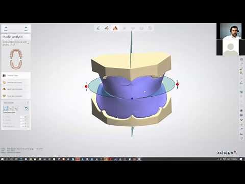 3Shape Dental System Full Denture Workflow