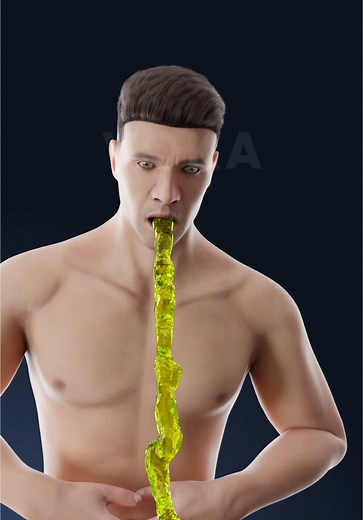 Understanding Vomiting: Body's Defense Mechanism Explained in 3D