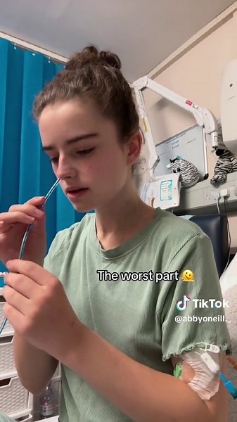 NG Tube Replacement Process: Step-by-Step Guide