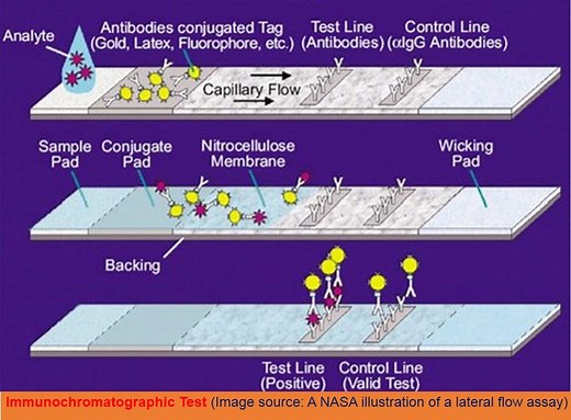 Immunochromatographic Test : Introduction, Principle, Procedure and resul