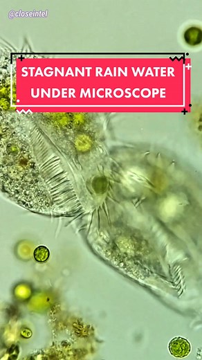 Microscopic World: Stagnant Rain Water Revealed