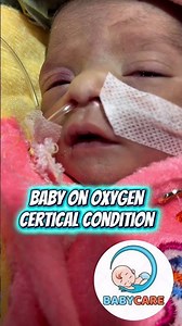 Baby on oxygen certical condition