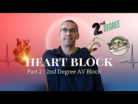 Heart Block Part 2 - 2nd Degree AV Block - Dr. David Barold I ECG Simplified