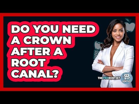 Do You Need A Crown After A Root Canal? - The Pro Dentist