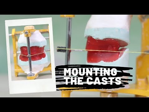 Mounting the casts on a mean value articulator | DEMO