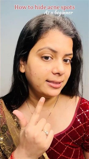 How to hide acne scars with makeup #makeuptips #makeup #makeuphacks #acnescars