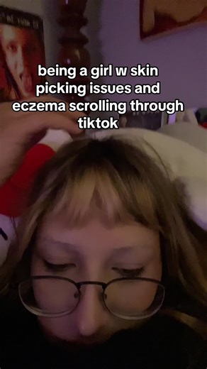 i was picking mg head scabs