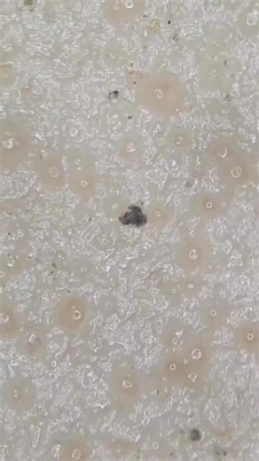 439K views · 1.5K reactions | Hot dog under the microscope! CREDIT: microozoomed | David Wolfe | Facebook