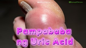 9.2M views · 194K reactions | https://buhayofw.com/pagkaing-pampababa-ng-uric-acid-sa-kidney-at-daluyan-ng-dugo-62b4392a26ad7 - Natural na Pagkain na pampababa ng uric acid sa kidney o bato | Buhayofw | Facebook