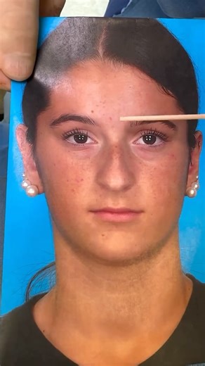 Facial Surgeons ™ on Instagram: "Dr. Rohrich (@rod.rohrich located in Houston, Texas) is a distinguished surgeon and respected professor, internationally recognized for his leadership in plastic surgery education and his mastery of rhinoplasty. With decades of experience shaping the future of aesthetic and reconstructive surgery, his approach blends science, artistry, and safety—especially important in teenage rhinoplasty. This journey highlights thoughtful planning, structural precision, and ag
