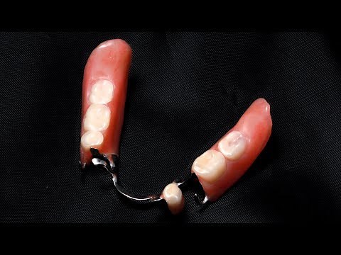 Cleaning Partial Dentures