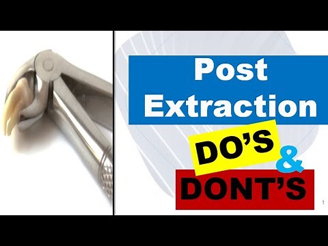 DENTAL POST EXTRACTION INSTRUCTIONS