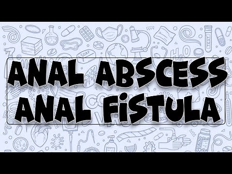 Anal Abscess and Anal Fistula | Causes | Signs and Symptoms | Diagnosis | Treatment | Complications