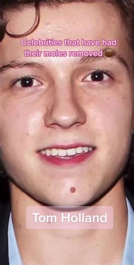 Minks Rejuvenation on TikTok