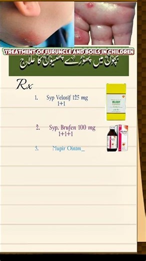 Treatment Of Furuncle And Boils in Children