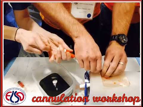 ECMO Cannulation