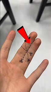 A Boy With Joined Fingers Received Such a Gift, Everyone Was Shocked 😲💍 #shortsvideo