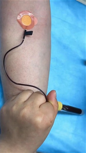 Intramuscular Injection Technique Explained | Safe IM Injection Step-by-Step |Nurse Guide Class N 74