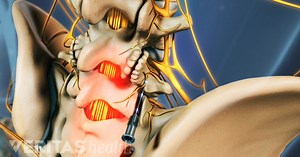 What Causes Sharp Lower Back Pain?