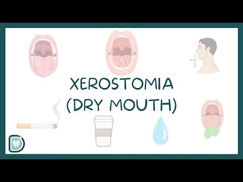Dry Mouth or Xerostomia: Causes, Symptoms, Diagnosis, and Treatment
