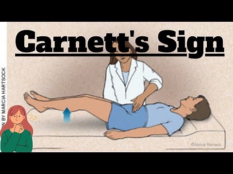 Carnett's Sign in Abdominal Examination | Clinical Insight for MBBS Students | Novice Medic