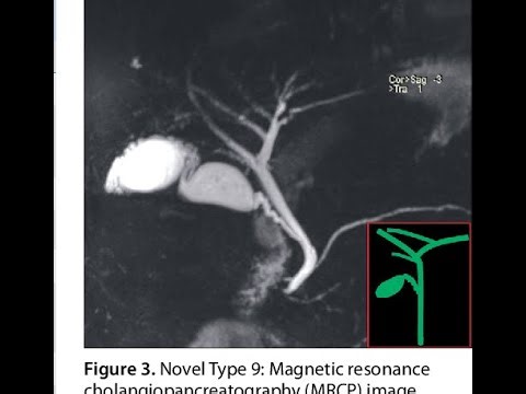 Magnetic Resonance Cholangiopancreatography ; Definition, Procedure, Advantages and Indications