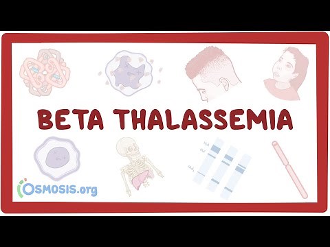 Beta-thalassemia - causes, symptoms, diagnosis, treatment, pathology
