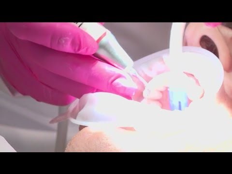 Newer 'Airflow' teeth cleaning reduces teeth scraping | FOX 5 News