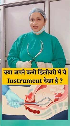 Forceps delivery kya hai #shotrs #shortsfeed #pregnancy #normaldeliverytips #forceps