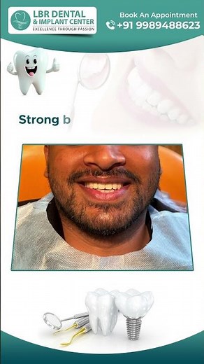 The Secret to a Perfect Smile Revealed: Front Teeth Implants by LBR Dental | Best Dental Clinic