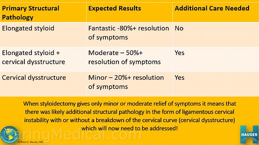 Eagle Syndrome Treatment | When to have Styloidectomy | Surgical and non-surgical approaches