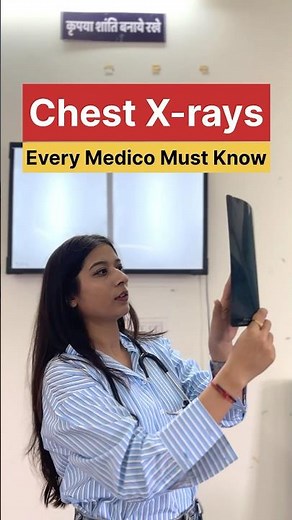 Chest X-ray 🩻 Basics #chest #radiology #xray #doctor #medicosstuff