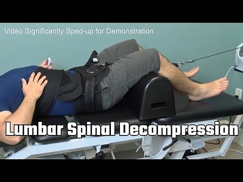 How Spinal Decompression Therapy Works | Spinal Decompression Demonstration