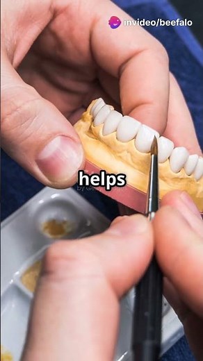 How False Teeth is Made?