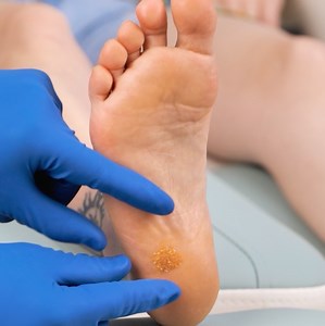 Smooth Feet in Minutes With This Medical Trick ✨ | Wood Mood