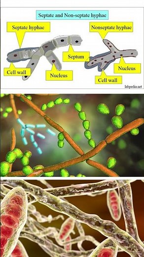 The Body of Fungus #Fungi #Mycology #Hyphae #Mycelium #Biology #Ecosystems #Decomposers #Nature