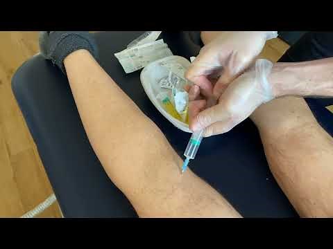 Removing Swelling Behind the Knee - How to Drain a Baker's Cyst