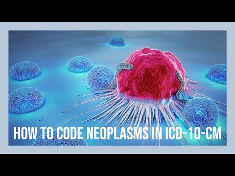 CODING NEOPLASMS IN ICD-10-CM