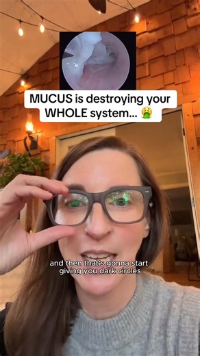 Waking up feeling congested and exhausted? That winter mucus is more than an annoyance, it's wrecking your sleep and energy. This NAC Detox Complex is designed to clear that congestion naturally. The powerful formula works to thin mucus, clear your airways, and boost your body's natural detoxification process. The result? Deeper sleep, clearer breathing, and more energy to tackle your day. ✅ Clear Mucus & Congestion ✅ Better Sleep & Recovery ✅ More Energy, Less Fatigue ✅ Lung, Liver & Kidney Sup