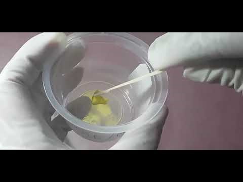 stool specimen collection