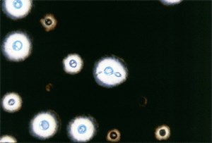 Cryptococcus neoformans: Pathogenesis, Lab Diagnosis