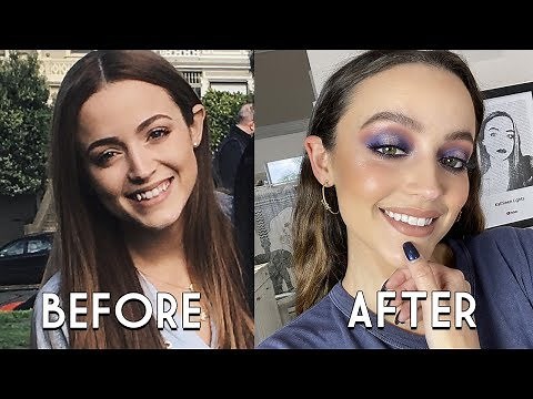 The truth about Invisalign...... Is it worth it?