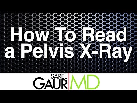 How to Read a Pelvis X-ray