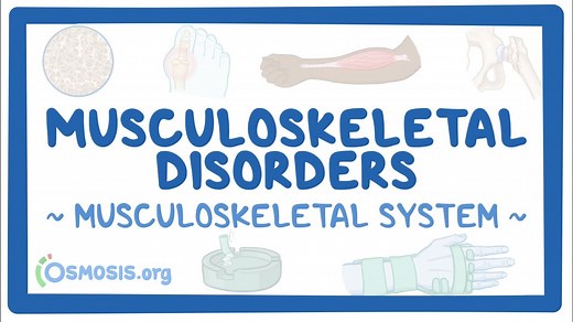 Musculoskeletal system: Musculoskeletal disorders: Video, Causes, & Meaning | Osmosis