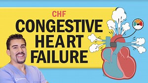 SimpleNursing Congestive Heart Failure Practice Questions with Answers and NCLEX® Review