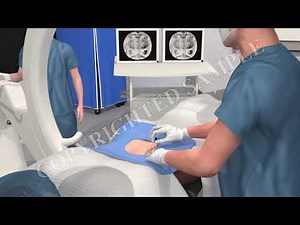 Epidural Steroid Injection - Surgical Procedure